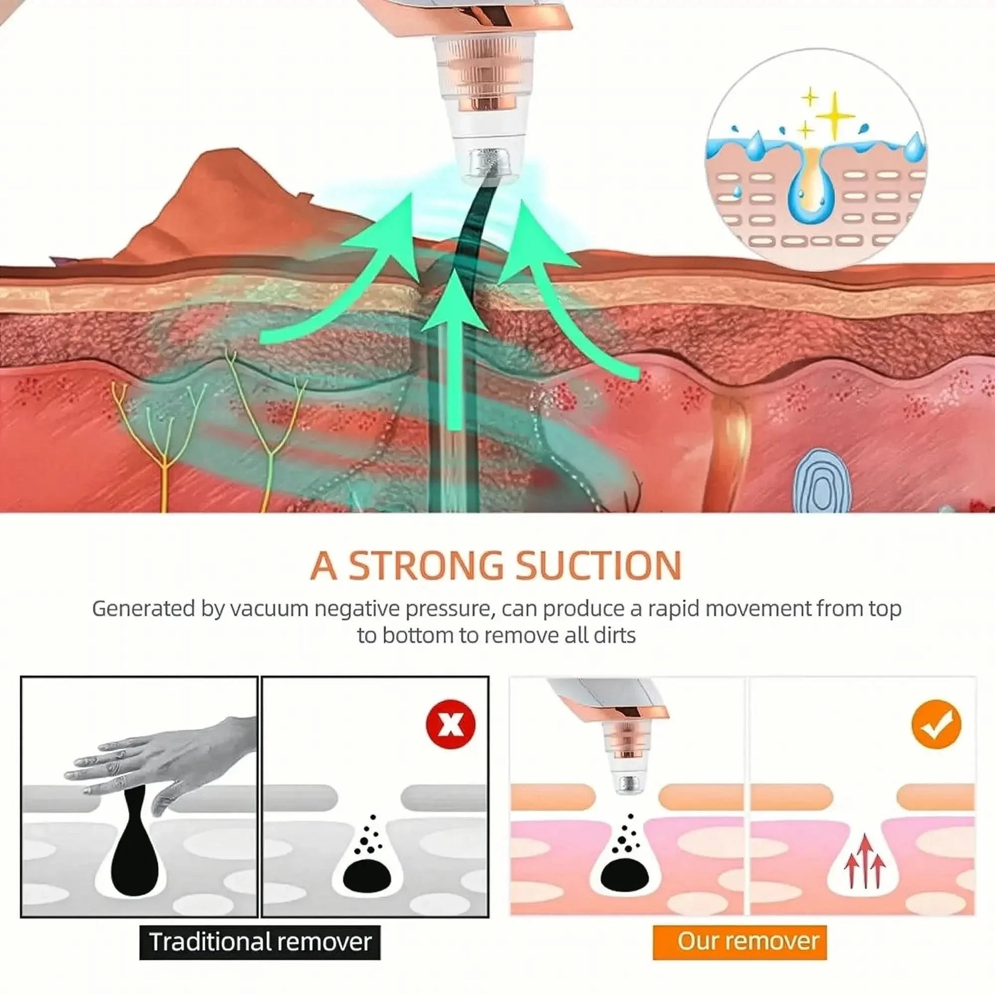Aspirateur Points Noirs Visage - Saylana
